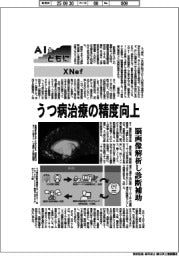 AIとともに/XNef うつ病治療の精度向上