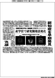 点描/認知症を早期発見 蓄積予測モデル・検査薬・PET 産学官で研究開発活発化