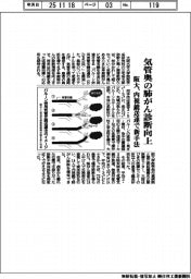 阪大、気管奥の肺がん診断向上 内視鏡送達で新手法