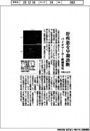 大阪公立大、肝疾患を早期診断　バイオマーカー候補発見