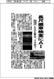 ＫＨＫ野田、長尺歯車検査にＡＩ　４分内に短縮　微細割れ見逃さず