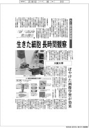 Ｆｏｒ　Ｆｕｔｕｒｅ先端技術（１６９）大阪大学　ＡＩ超音波望遠鏡