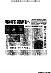 ニュース拡大鏡/QST、精神障害病態解明へ 早期発見に道