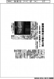 島津製作所、膝関節側面の撮影支援　Ｘ線装置　位置補正ソフト